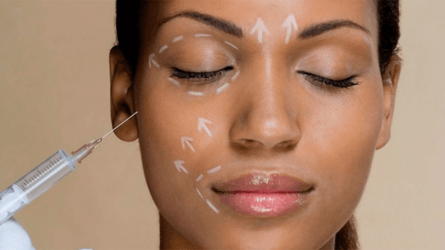 Facial Rejuvenation